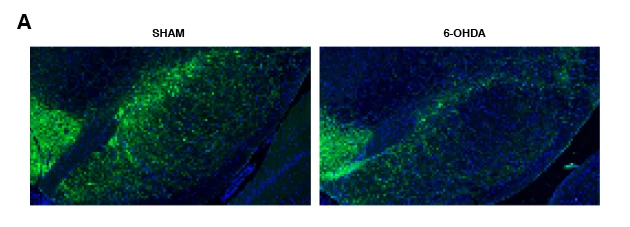 Figure A: Immunohistochemistry of striatum of Vehicle versus 6-OHDA treatment groups and a graph of the quantification of these two groups.