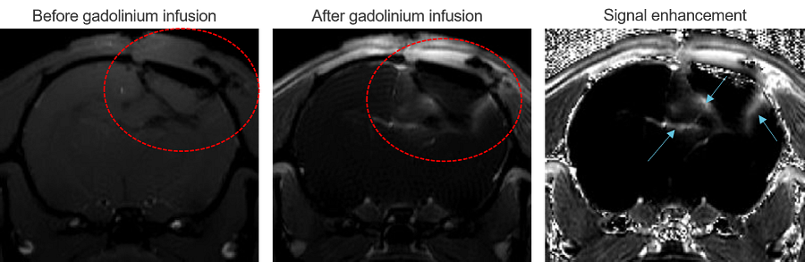 Example MRI images before and after gadolinium contrast injection