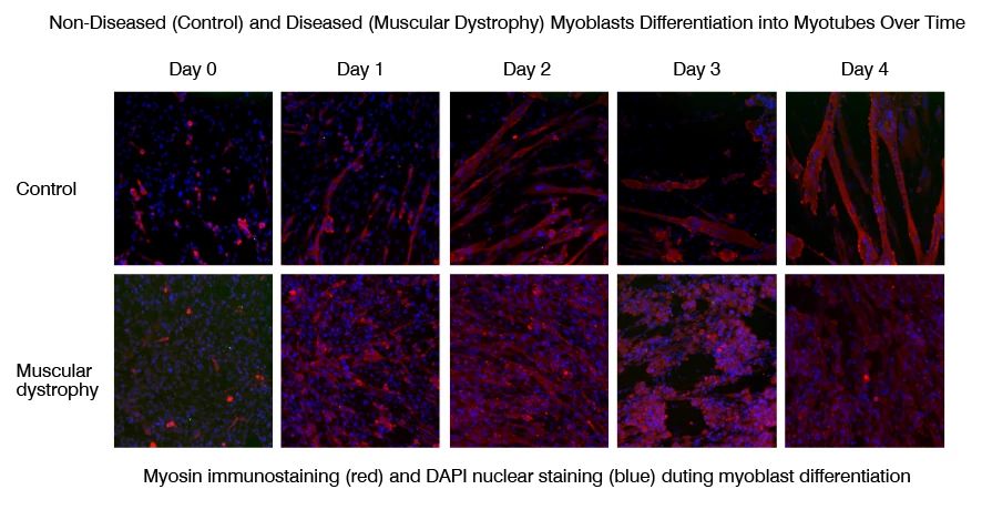 Myotube differentiation in control and muscular dystrophy cell lines