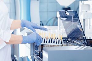 lab technician working with blood samples