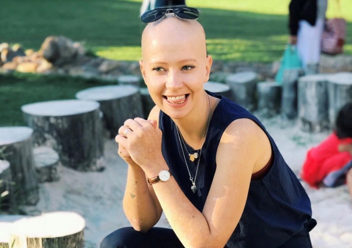 Toni Roberts, a South African woman living with epidermolysis bullosa