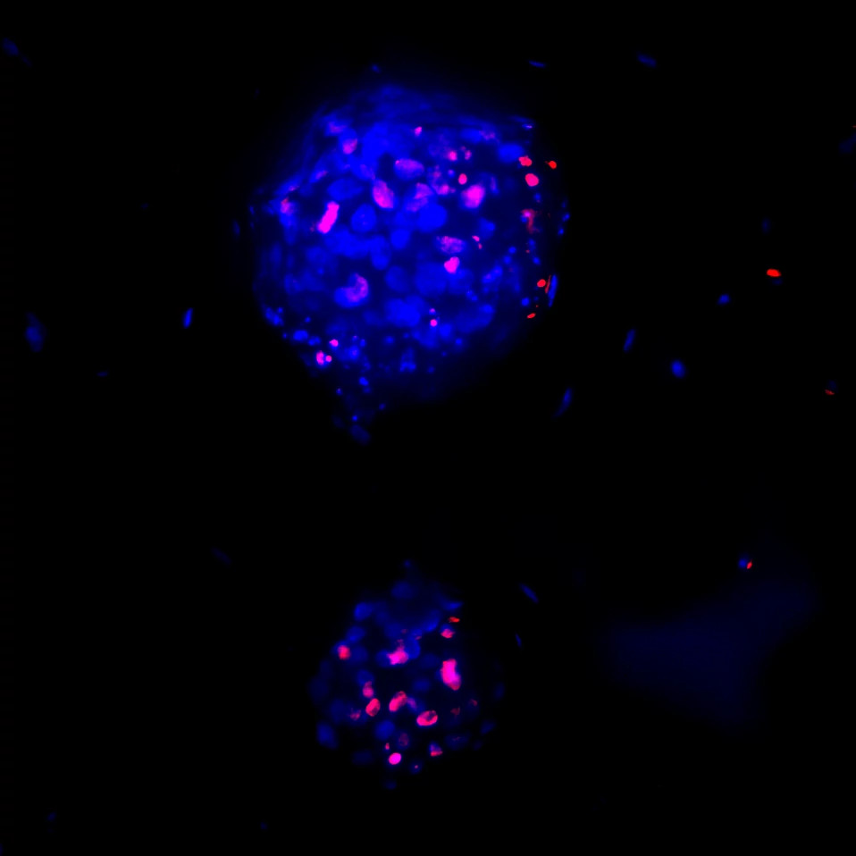 3D 20x confocal image of tumor model