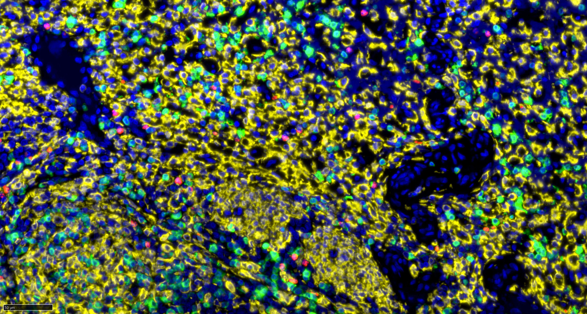 Iba1 MPO CD3 IF Pig Spleen