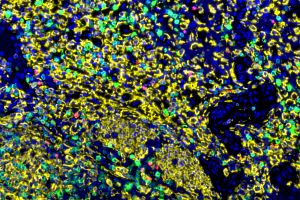 Iba1 MPO CD3 IF Pig Spleen