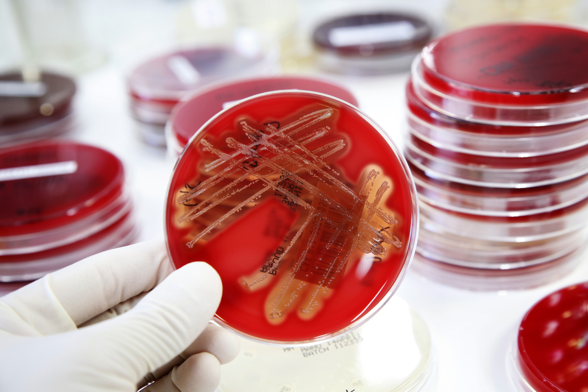 gloved hand holding a petri dish with red agar blood on it