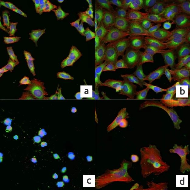 Image of HeLa cells stained with multiple fluorescent dyes after exposure to the compounds Cytochalasin, Lovastatin, Latrunculin and Nocodazole.