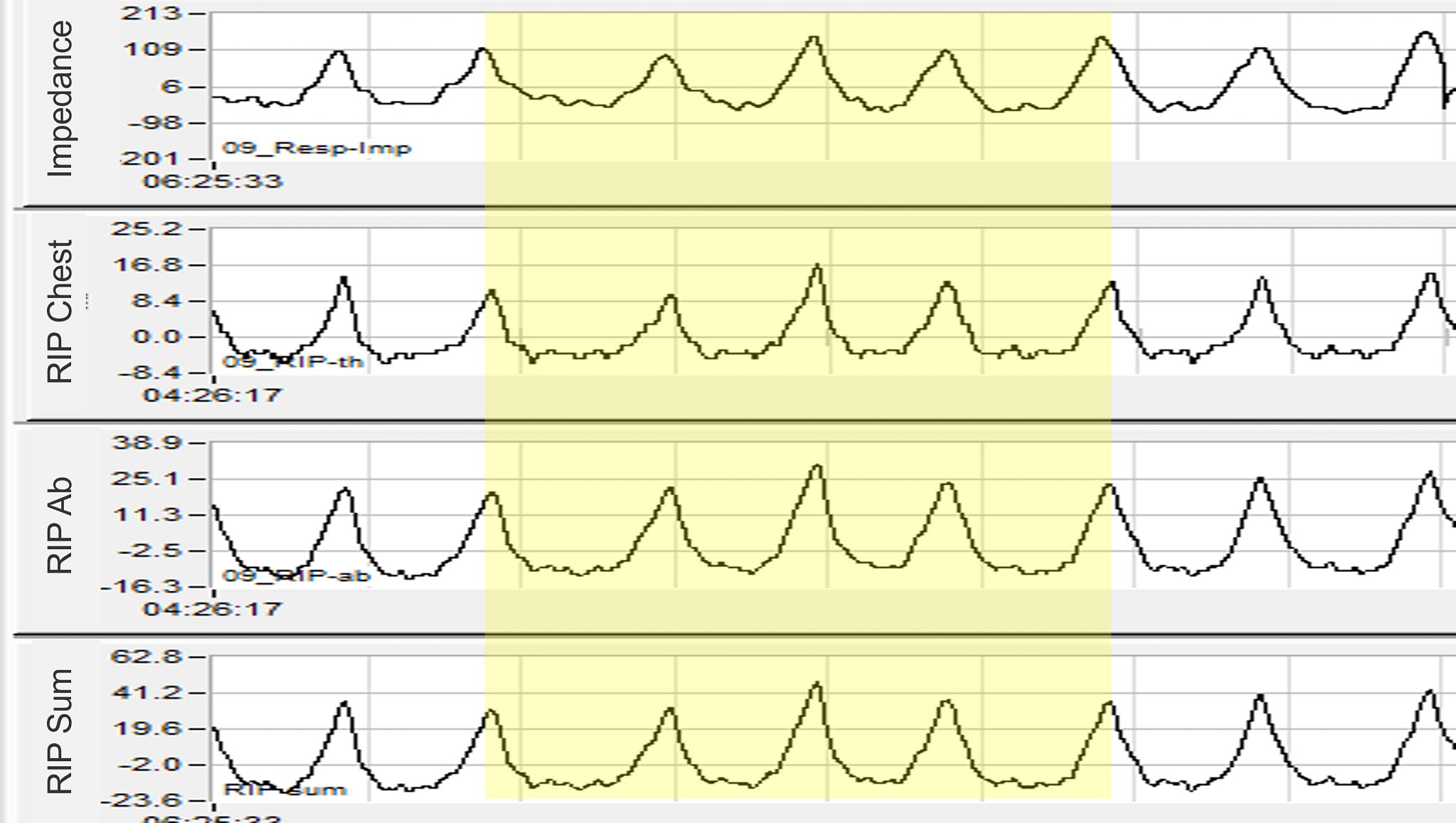 An Innovative Assessment of Respiratory Function in Safety Pharmacology ...