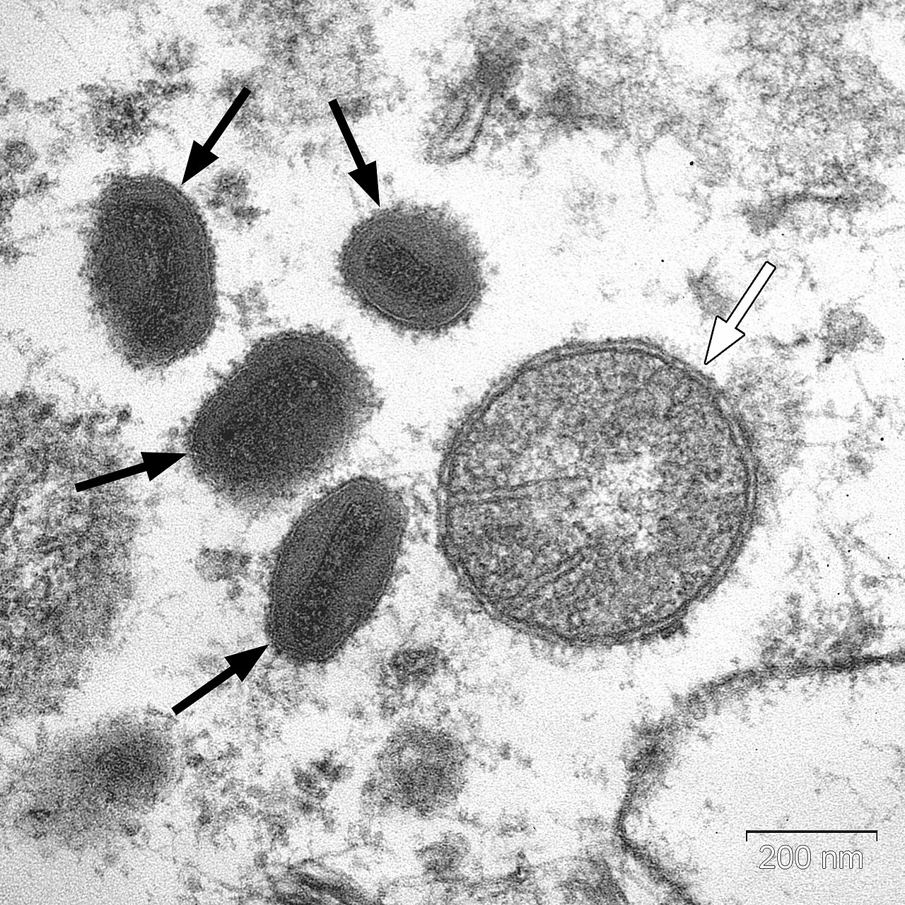 Vaccinia_virus_particles.jpg