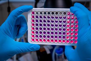 Gloved hands of a scientist are holding up a 96-well assay plate typically used in uptake SLC transporter interaction assessment experiments.