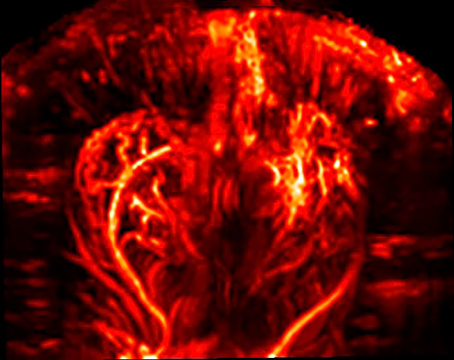 functional ultrasound image of the rat brain