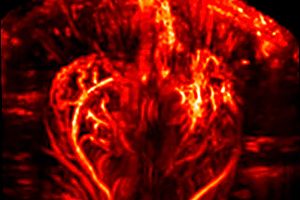 A functional ultrasound image of the brain illustrates one of many preclinical imaging capabilities for neurological diseases.